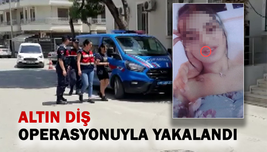 “Altın Diş” operasyonuyla yakalandı